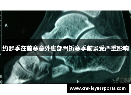 约罗季在前赛意外脚部骨折赛季前景受严重影响